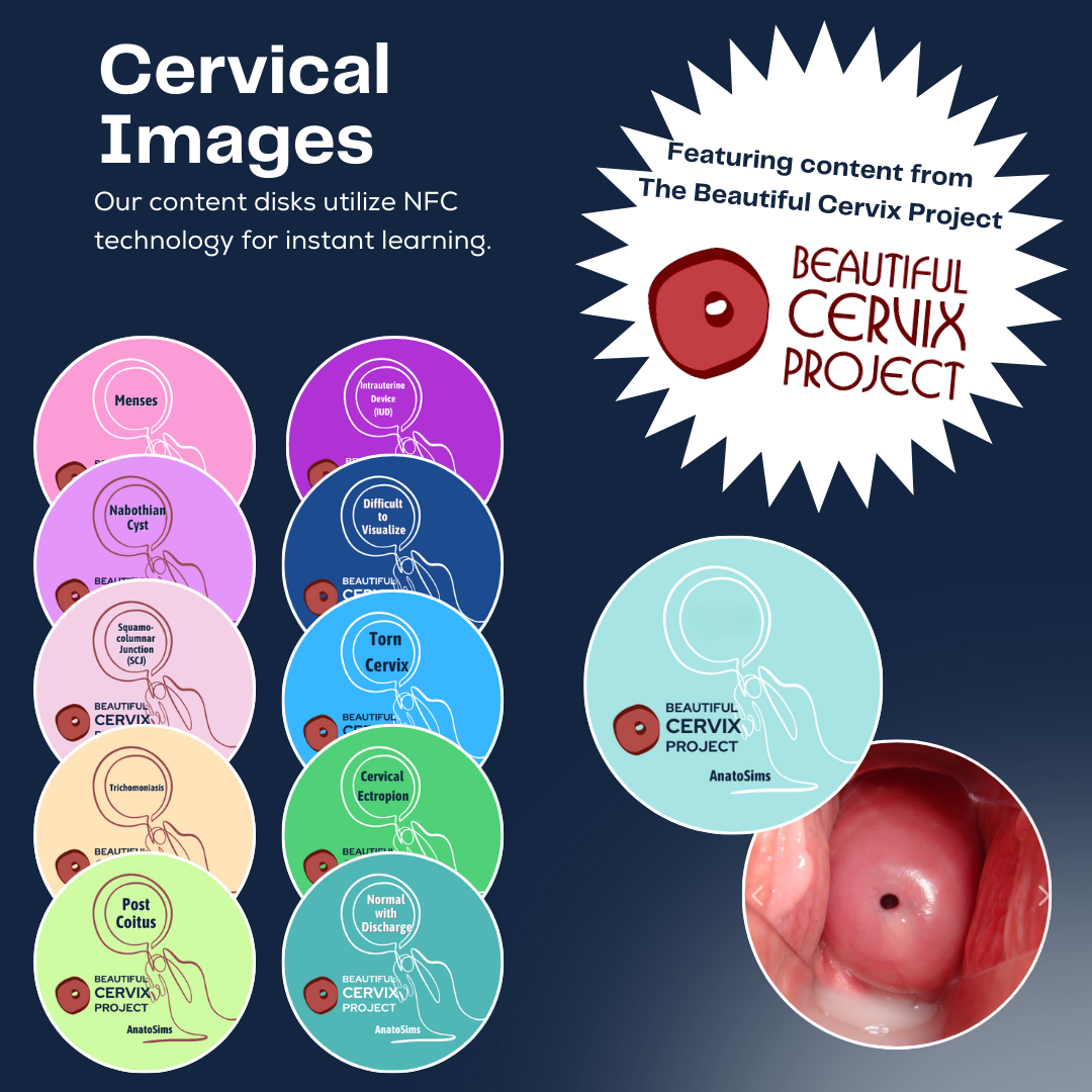 10-disk cervical set